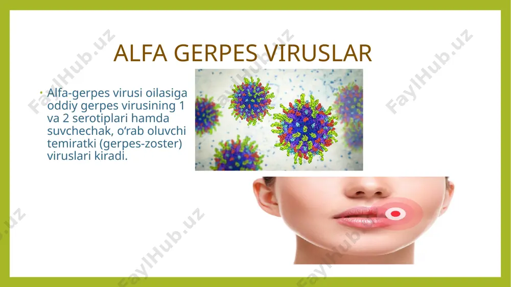 a ii serotiplarini formalinda o‘ldirib tayyorlangan vaksina bilan 5–6 marta emlanadi. image1.png image2.png image3.png image4.png image5.png image6.png image7.png image8.png image9.png image10.png image11.png image12.png image13.png image14.png image15.png /docprops/thumbnail.jpeg
