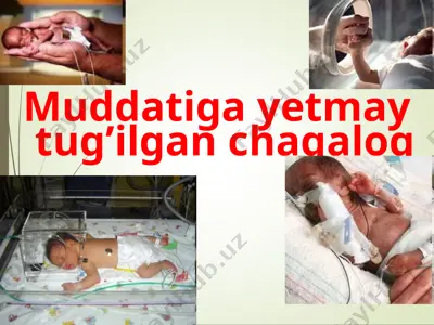 muddatiga yetmay tug’ilgan chaqaloq — PPT