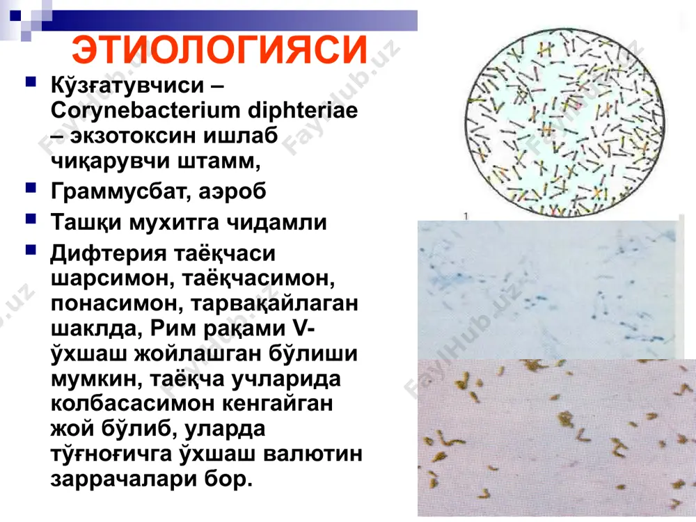 и, интоксикацион белгилар кузатилмайди. бошланишда бурунни бир томони шиллиқ қаватида жароҳатланиш бўлиб, сероз йирингли ёки қонли йирингли модда ажраши кузатилади. тез орада буруннинг иккинчи томони ҳам яллиғланиши мумкин. бурун четларида қатқалоқ пайдо бўлади. бурун дифтериясини тарқалган шаклида патологик жараён бурун бўшлиқларига ёйлади. бурун дифтериясининг токсик шаклида лунж ва бўйинда шиш пайдо бўлади. ўзгаришлар характерига қараб 2 хил шаклига фарқланади: катарал-ярали шакли – эрозиялар, яралар, қипиқлар. пардали шакли – қалин оқиш-кулранг пардалар, шиллик қават билан бирлашган ҳолда. бурун дифтерияси бурун дифтерияси томоқ дифтерияси 90-95% холларда кузатилади. қуйидаги клиник шакллари кузатилади ўчоқли формаси: дифтерия пленкаси фақат бодом бези устида бўлади ўчоқли шакли: плёнкали, оролчасимон, катарал турлари фарқланади тарқалган формаси: бунда дифтерия плёнкаси бодом безларидан ташқарига – юмшоқ танглайга, тилчага тарқалади токсик формаси: бу жуда оғир формаси ҳисобланади субтоксик токсик i, ii, iii даражада гипертоксик формада геморрагия синдроми билан кечади. томоқ дифтерияси дифтериянинг локал шакли оролчасимон шакли – оролчали, фибринозли, қаттиқ ёпишган плёнкалар …