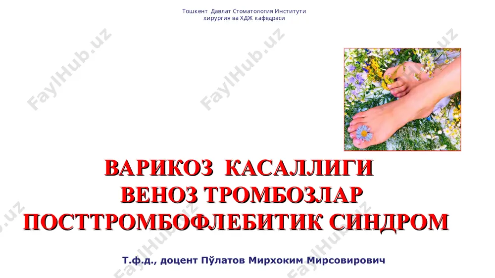 eleangioektaziya, retikulyar varikoz i utib ketuvchi shishish, varikoz transformatsiya ii turg'un shishish, giperpigmentatsiya, lipodermoskleroz, ekzema iii indurativ tsellyulit, trofik yara, ikkilamchi limfedema sear klassifikatsiyasi (slinical etiological anatomical pathophysiological,1994) klinik kurinishi 0 – kasalik belgilari kurinmaydi i – teleangioektaziyalar, retikulyar varikoz ii – varikoz venalar iii – shishish iv – trofik uzgarishlar v – trofik uzgarishlar + yopiq yara vi – trofik uzgarishlar + ochiq yara etiologiya birlamchi ikkilamchi anatomichesk segment yuzaki venalar chuqur venalar patofiziologiya reflyuks okklyuziya reflyuks va okklyuziya v 1994 godu gruppa amerikanskogo venoznogo foruma sozdala klassifikatsiyu sear * kurik * davolash xirurgik endovaskulyar flebosklerozlovchi tarix otto wilhelm madelung (1846-1926) madelung operatsiyasi (1884) tarix 1888 y. – troyanov 1890 y. – trendelenburg aleksey alekseevich troyanov (1848-1916) friedrich trendelenburg (1844-1924) tarix 1906 g. – narat william wayne babcock (1872-1963) albert narat (1864-1924) 1907 g. – bebkokk tarix 1938 y. – robert linton 1955 y. – d.felder 1985 y. – …