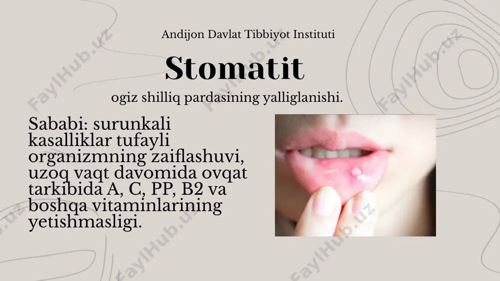 , et junjikishi, gipertermiya, keskin adinamiya, qorinda og’riq, ko’ngil aynishi, qusish, giperleykotsitoz bilan neytrofilli siljish (toksik donadorlik bilan), soe oshishi va yallig’lanishning boshqa alomatlari bilan xarakterlanadi. prognozi xayrli emas. davolash xirurgik yo’l bilan bo’ladi. surunkali gastrit me’daning surunkali distrofik yallig’lanishi bo’lib, unda me’daning shira ajratishi va harakat qilishi buziladi. surunkali gastrit ovqat hazm qilish a’zolari orasida yetakchi o’rinni egallaydi. andijon davlat tibbiyot instituti andijon davlat tibbiyot instituti endogen sabablarga: surunkali yallig’lanish (og’iz bo’shlig’i, halqum va nafas olish organlarining yallig’lanish kasalliklari, o’pka sili, surunkali xoletsistit, enterokolit va h.k.); endokrin bezlari kasalliklari (addison kasalligi, gipoterioz, buqoq, itsenko— kushing kasalligi, qandli diabet); kasallangan a’zolardan reflektor ta’sir o’tishi (xoletsistit, gepatit va b.); modda almashinuvining buzilishi (o’ta semizlik, organizmda temir moddasining yetishmovchiligi, padagra); to’qimani gipoksiyaga olib keluvchi kasalliklar (yurak-tomirlar yetishmovchiligi, jigar va buyrak yetishmovchiligi); allergiya natijasidagi surunkali gastrit kiradi surunkali gastritning kelib chiqishida ekzogen sabablarga 1982- yilda avstraliyalik olimlar varren va matchkllar spiralga o’xshagan bakteriyaning …