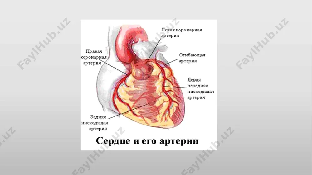 i dayiladi). v. ekg belgilari bo’yicha 1. patologik - q tishli - barqaror okklyuziv koronar arteriya trombozi tufayli rivojlanadi, trombolitik terapiya samarali 2. q tishi ekvivalenti–r tishi amplitudasi o’zgarishi 3. patologik - q tishsiz 4. q tishsiz mi (mayda o'choqli) - q tishcha hosil bulmaidi, balki t tishcha manfiy bo’lishi bilan namoyon bo'ladi. 5. s-т segmentining ko’tarilishi bilan kechadigan mi (intramural) kechishi ijobiy, lekin qaytalanish ehtimoli yuqori, trombolitik terapiya tavsiya qilinadi. 6. s-т segmentining depressiysi bilan kechadigan mi (subendokardial) og’ir kechadi prognostik jihatdan noqulay. vi. mi asoratlari mavjudligi bo’yicha : erta asoratlari- kardiogen shok, o'tkir yurak etishmov-chiligi, yurakning yorilishi, oshqozon-ichak traktining o'tkir zararlanishi, epistenokardial perikardit, yurakning o'tkir anevrizmasi, papiller mushaklarning shikastlanishi, tromboembolik asoratlar, ritm va o'tkazuvchanlikning buzilishi. kechki asoratlari infarktdan keyingi sindromi (dressler sindromi) surunkali yurak anevrizmasi surunkali yurak etishmovchiligi ritm va o'tkazuvchanlikning buzilishi. miokard infarkti boshlanishining klinik variantlari 1. ogriqli - anginoz varianti (status anginosus); 2. miokard infarktining atipik …