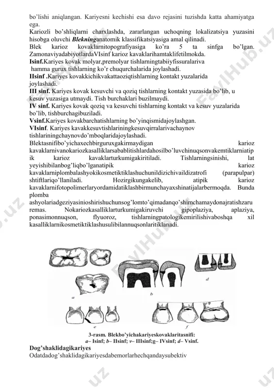 chi gipoplaziya, aplaziya, ponasimonnuqson, flyuoroz, tishlarningpatologikemirilishivaboshqa xil kasalliklarnikosmetiktiklashusulibilannuqsonlaritiklanadi. 3-rasm. blekbo’yichakariyeskovaklaritasnifi: a– isinf; b– iisinf; v– iiisinf;g– ivsinf; d– vsinf. dog’shaklidagikariyes odatdadog’shaklidagikariyesdabemorlarhechqandaysubektiv sezgilarniqaydqilmaydilar. ayrimhollardabemorlartishningqamashishidanshikoyatqiladilar. emaldemineralizatsiyasichegaralangan yuzadaranginingo’zgarishi, unioq, ochjigarrang, to’qjigarrangdan qong’irtusgachabo’lishikuzatiladi. kasalliktishningchegaralangan qismida emalyaltiroqliginiyo’qolishibilanboshlanadi. odatdabundayo’zgarishlartishningbo’yinqismidajoylashadi. zondlagandaushbuyuzatekis, og’riqsiz. vitalbo’yashsinamasidadog’ko’kranggabo’yaladi. eoddatishpulpasi 2–6 mkagajavobberadi. transillyuminatsiyadog’ninghajmivajoylashishidanqat’iynazaraniqlanadi. dog’shaklidagikariyesflyuorozvagipoplaziyabilansolishtirmatashxiso’tkaziladi. yuzakariyes yuzakariyeshosilbo’lgandog’kariyeso’rnidadestruktivo’zgarishlarnatijasidahosilbo’ladi. bemorximikta’sirlarshirin, sho’r, nordondanhosilbo’ladiganqisqamuddatliog’riqdanshikoyatqiladi. agarkariyeskovagitishningbo’yinqismidajoylashganbo’lsatermikta’sirdanhamog’riqpaydobo’lishimumkin. ko’riko’tkazilibzondlagandakichiknuqsonaniqlanadi. nuqsonfaqat emalqavatidajoylashadi. elektrsezuvchanlik 2–6 mkatengbo’ladi. yuzakariyesni aniqlashdagipoplaziya, tish eroziyasi, ponasimonnuqsonbilan solishtirmatashxiso’tkaziladi. o’rtakariyes o’rtakariyesdanuqson emal, dentinchegarasidano’tibo’rtachachuqurlikka egabo’ladi. aksariyathollardabemorog’riqsezmaydi. kamdan-kamhollardabemortermik, mexanik, ximikta’sirlardanpaydobo’ladiganqisqamuddatliog’riqdanshikoyatqiladilar. ko’riko’tkazilib, zondlagandao’rtachachuqurlikka egabo’lgankariyeskovagiborligi, kovaktubidayumshagandentinborligiuchung’adirbudurliligianiqlanadi. o’rtakariyesnianiqlashdaponasimonnuqson, eroziya, surunkaliperiodontitbilansolishtirmatashxiso’tkaziladi. gipop