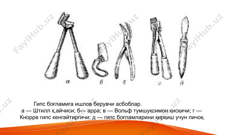 и эркин бурмалари силлиқланади. лонгета оёқ ёки қўл айланасининг 1/2-2/3 га қамраб олиши керак айланма гипс боғлами қўйилгач, 24-48 соат мобайнида уни назорат қилиш керак чунки шиш пайдо бўлиб, сиқиши ва оғир асоратларга олиб келиши мумкин, ҳатто ишемик контрактура, фалажлик ва қўл ёки оёқ гангренаси юз бериши эҳтимол. хамма турдаги гипс боғламлар гипсли лонгеталарга ва айланма боғламларга бўлинади. айланма боғламлар дарчасимон ва кўприксимон бўлади. гипс боғламларининг турлари. а — гипс лонгетаси; б — айланма гипс боғлами; в — коксит гипс боғлами; г — гипс корсети; д — контрактурани тўғриловчи гипс боғлами; е — кўприксимон гипс боғлами. тортма хозирги пайтда кўп тарқалган турларига елимли ва скелет тортмалар киради. елимли тортмалар унинг скелет турига нисбатан кам холларда ишлатилади. елимли чўзиш. бу усул учун кўрсатмалар кам ва синишлар бурчак остида, периферия бўйича ва энига кўзғалганда ишлатилади. бунда юк хатто сон суяги синганда хам 4-5 кг дан ошмаслиги керак боғлам терига ёпиштириладиган дока тилишлари …