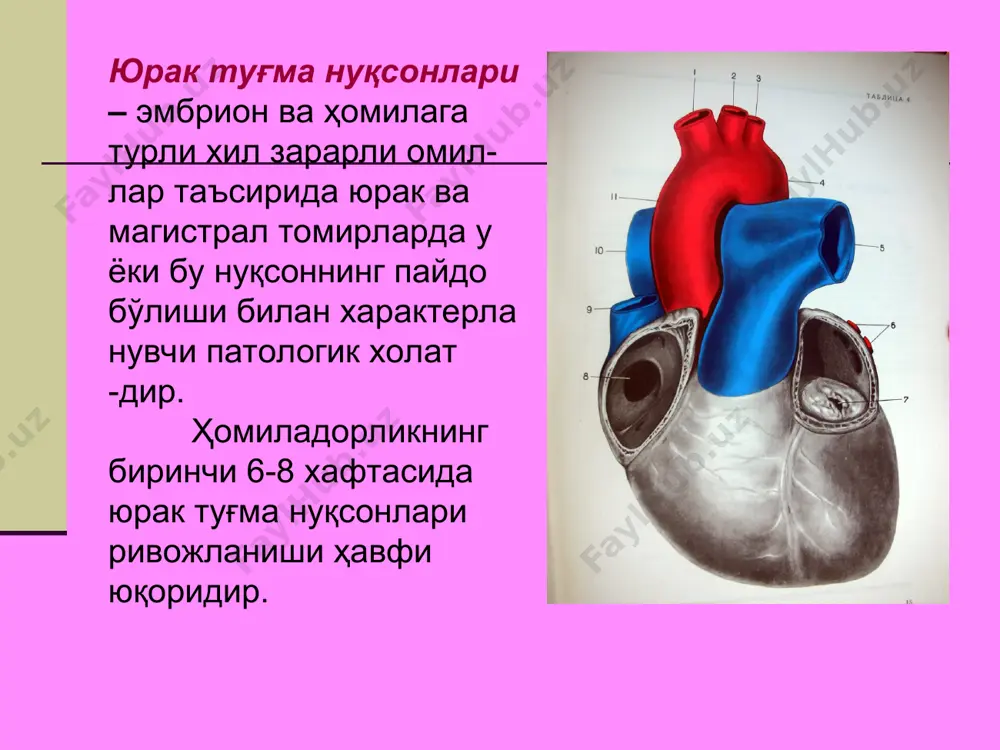 ртериясида босим ортади ва ўпка қаршилиги кучаяди,қоннинг чапдан ўнгга ўтиши камаяди склеротик – ўпка томирларида ортга қайтариб бўлмайдиган ўзгаришлар вужудга келади қоринчалар аро тўсиқ нуқсони кичик нуқсон (0,5 см гача): ўнг қоринчадаги босим ортиши учун етарли эмас. ўпка қон айланишининг системали қон айланишга нисбати 1,75 дан катта эмас. ўрта нуқсон ( 0,5 дан 1,0 см гача) ўнг қоринчадаги босимнинг ортиши учун деярли етарли ва чап қоринча босимининг ярмига тенг, ўпка қон айланишининг системали қон айланишга нисбати 3,5 гача катта нуқсон (1 см дан кўп): бунга аорта ўлчамига тенг ва ундан катта нуқсонлар киради қоринчалар аро тўсиқ нуқсони қоринчалар аро тўсиқ нуқсони клиникаси тез чарчаш, жисмоний зўриқишдан сўнг хансираш; юрак букри, юрак турткисининг кучайиши, кўкс суягидан чап томонда 3-5 қовурғалар оралиғида систолик титраш; ўпка артерияси устида ii тон акценти, юрак устида дағал систолик шовқин, максимал эшитилиш жойи кўкс суягидан чапда 3-4 қовурға оралиғида. қоринчалар аро тўсиқ нуқсонида гемодинамика бузилишининг схемаси i …