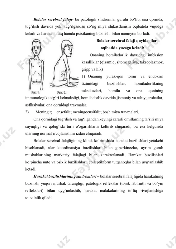 si keskin ko‘tarilgan: bola yarim buqilgan holatda o‘rta chiziqqa keltirilgan oyoqlarda turadi, yurganda oyoqlarning chalinib ketishi kuzatiladi. yirik bo‘g‘im tuzilishining buzilishlari rivojlanadi. paylar refleksi yuqori, oyoqlar klonuslari kuzatiladi. spastik gemiplegiyada buzilishlar ko‘pincha bir tomonda bo‘ladi qo‘lda ko‘proq mushakning bukilish tonusi ko‘tarilgan, oyoqda esa tiklanish tonusi ko‘tarilgan. shuning uchun qo‘l tirsak bo‘g‘imidan buqilgan bo‘lib, tanaga yaqinlashgan, barmoqlar esa mushtum qilib yig‘ilgan. oyoqlar esa ichkariga buqilgan. bola yurganda barmoqlariga tayanadi. serebral falajning gemiparetik shaklsida bolada alalliya hisobiga nutq rivojlanishi kechikishii mumkin, ayniqsa chap yarim sharlari shikastlanganda katta yoshdagi bolalarda 50% giperkinezlar kuzatiladi. ular mushak tonuslarining pasayishi me’yoriga qarab paydo bo‘ladi. ruhiy rivojlanish sekinlashadi. kechikishi darajasi yengildan murakkabgacha o‘zgarib turadi. rivojlanishning kechikishiiga tez-tez takrorlanadigan epileptiform tutqanoqlar ta’sir ko‘rsatadi. ikkilamchi gemipligiya – oyoq-qo‘llardagi harakatlaninshning buzilishi bilan xarakterlidir, biroq odatda qo‘llar oyoqlarga nisbatan ko‘proq aziyat chekadi. qo‘llarning, yuz mushaklarning og‘ir jarohati nutq va psixikaning rivojlanishining kechikishiiga olib keladi. bunday bolalar o‘tira olmaydilar, yura olmaydilar, o‘zlarini …