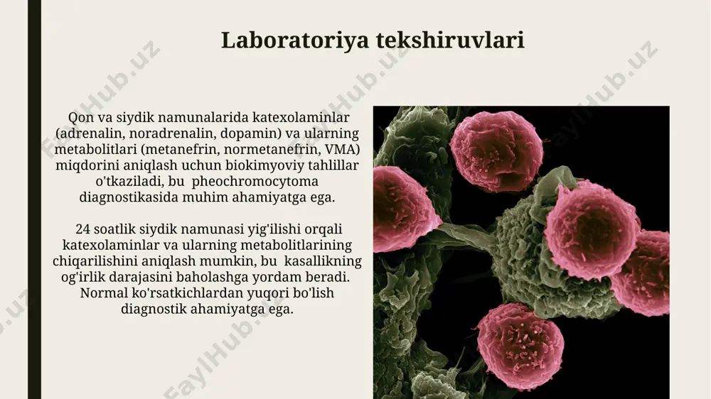 feoxromatsitoma va davolash usullari - Page 5