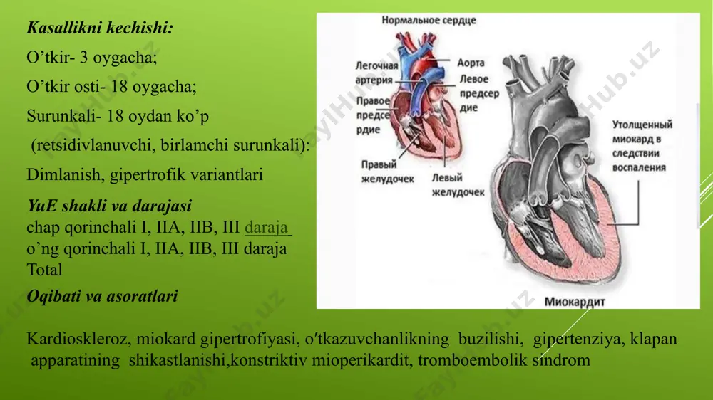 ining keskin kichrayishi- (restriktiv variant) uning asosida chap qorincha miokardi birlamchi diastolic funksiyasi buzilishi yotadi davolash 2 xil bo’ladi : statsionar va poliklinik -glukokortikoidlar: prednizalon -aminoxinolon qatori dorilari- delagil, plakvinil -yurak glikozidlari –digoksin -salitsilatlar buyuriladi ye bosqichlariga mos ravishda quyidagi diuretiklarni tayinlash rejasini tavsiya etish lozim i-ii a bosqichidagi chap qorincha yetishmovchiligi –veroshpiron ii a bosqichli chap qorincha yetishmovchiligi+ ii a-b bosqichdagi o’ng qorincha yetishmovchiligida – furasemid ichishga va veroshpiron total ii-b-iii-furosemid yoki lazeks parenteral veroshpiron bn birga , samarasiz bo’lganda brinaldiks yoki uregit qo’shiladi karditli bolalarni dispanserizatsiya qilish mutaxassis ko’rigi amalga oshirilishi: statsionardan chiqqandan so’ng oyiga 1 marta -3 oy, kvartalda 1 marta 6-9 oy, keyin 6 oyda 1 marotaba pediatr , kardiorevmatolog, lor- vrach, stomotolog, aminoxinolin dorilari bn davolashda 3-6 oyda okulist nazorati ostida bo’lishi lozim. kuzatuv davomiyligi: 3yildan kam bo’lmasligi kerak, kasallik qo’zishi davrida , uzoq davom etganda 5 yildan kam emas, surunkali kechishida bolalarni 15 yoshdan …