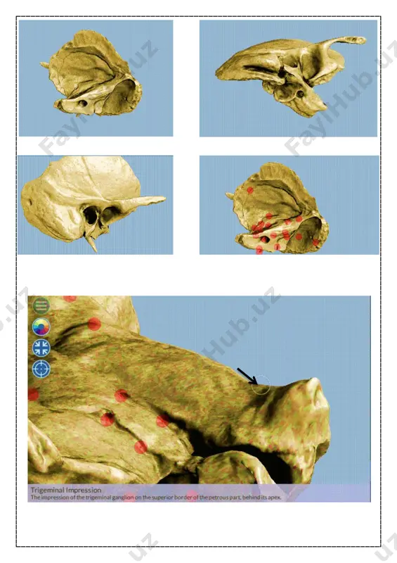 chakka suyagi (trigeminal impression) - Page 3