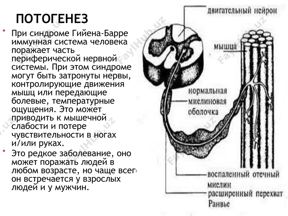 a funktsiy sfinkterov. 3. narusheniya funktsiy sfinkterov v nachale zabolevaniya. 4. bolee chem 50 mononuklearnix leykotsitov v likvore. 5. nalichie polimorfnoyadernix leykotsitov v likvore. 6. chetkiy uroven chuvstvitelnix narusheniy. diagnostika vklyuchaet v sebya takie obsledovaniya: standartnie zabori krovi i mochi, viyavlenie antitel campylobacter jejuni. issleduyutsya kletochnie protsessi. issleduetsya krov na bioximiyu, likvor – kontsentratsiya belka v spinnomozgovoy jidkosti. obyazatelno provodyatsya serologicheskie issledovaniya, chtobi isklyuchit bolezni, imeyushie sxojie simptomi – ix ne tak malo: miastenii, ostriy i poperechniy mielit, entsefaliti razlichnix etiologiy, neyroborrelioz, tsitomegalovirus i nekotorie podobnie po simptomam zabolevaniya. sdaetsya analiz mochi, chtobi isklyuchit otravlenie lekarstvennimi preparatami, solyami tyajelix metallov. provoditsya emg – elektoromiografiya – registriruyutsya proizvolnie sokrasheniya skeletnix mishts v sostoyanii pokoya. pri etom issledovanii v mishtsu vvodyat elektrod v vide igli i opredelyayut vremya provedeniya elektricheskogo razryada po nervu. lechenie bolnie s diagnozom sindrom giyena-barre podlejat gospitalizatsii, tak kak inache podderjivat jiznennie funktsii prosto nevozmojno. v terapevticheskie meropriyatiya …