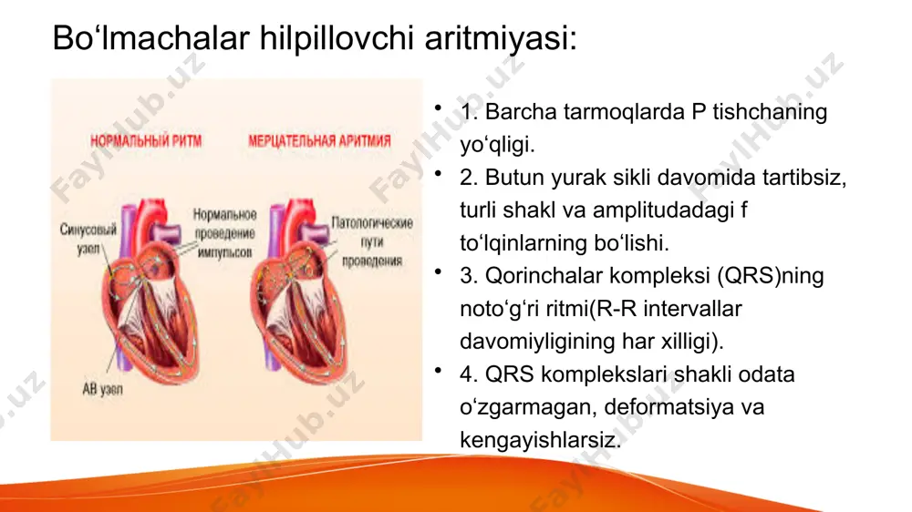 rd infarktida juda ehtiyotkorlik bilan buyurish kerak. mumkin bo'lgan aritmogen ta'sir. to'plam shoxlari bloki, birinchi darajali atrioventrikulyar blokada, miyasteniya, bronxial astma, jigar va / yoki buyrak etishmovchiligi, surunkali yurak etishmovchiligi, koronar arteriyalarning tiqilishi tufayli qorincha taxikardiyasi, jarrohlik aralashuvlar (jumladan, jarrohlik stomatologiyasi), og'ir ateroskleroz, qarilik. xinidin xinidin - sinkona daraxti qobig'ining asosiy alkaloidi , xininning stereoizomeridir . tibbiyotda antiaritmik vosita sifatida ishlatiladi . 2012 yildan beri xinidin hayotiy va muhim dorilar ro'yxatidan chiqarildi . 2013 yildan boshlab rossiyada ro'yxatdan o'tish bekor qilindi. xinidin hujayralarning potentsial eshikli natriy kanallarini bloklaydi, bu depolarizatsiya tezligining pasayishiga va shunga mos ravishda yurak o'tkazuvchanligi tizimining hujayralari va kardiyomiyositlar orqali ta'sir potentsialining tarqalish tezligining pasayishiga olib keladi . natriy kanallarini blokirovka qilish orqali preparat ikkilamchi tartibli avtomatizm markazlarida (atrioventrikulyar tugun, his, purkinye tolalari to'plami) sekin o'z-o'zidan depolarizatsiyani kamaytiradi, ammo sinoatrial tugunga deyarli ta'sir qilmaydi, chunki sekin o'z-o'zidan depolarizatsiya va depolarizatsiya fazalari kanallar orqali o'z-o'zidan oqib chiqadi. etmozin …