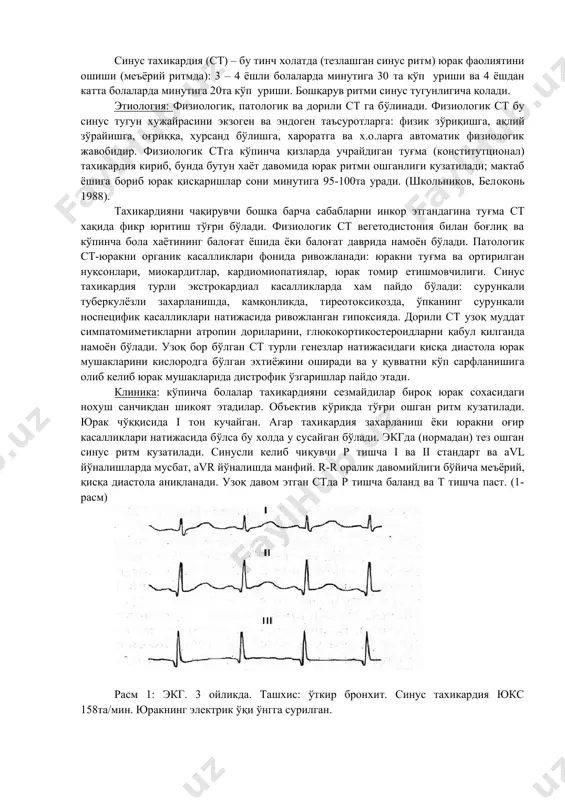 и клиник фикрлашга, электрокардиографик текшириш эса аритмия характери ва патогенезини аниқлашга ёрдам берди. хар қандай холатларда хам аритмия сабабини аниқлаш шифокор учун мухим масала хисобланади; яъни у сабабни юракни ёки юракдан ташкари (экстрокардиал) кузатилган бирон бир касалликка боғлиқлигини аниқлаши керак. агар юрак ритмини ёки ўтказувчанлигини бузилиши юрак касалликлари ва экстракардиал жараёнлар натижаси остида юзага келса, у асорат сифатида қаралади. масалан, туғма юрак нуқсони бор бола экг сида гисс ўнг оёқ тутамини нотўлиқ блокадаси ва нотўлиқ атривентрикуляр i-даражали блокадаси деб таснифланди. бу холатда аниқланган импульс ўтишини бузилиши юрак туғма нуқсони асоратига киритилади. агар болада юрак ритмини бузилиши бирон бир юрак қон томир тизимини зараланиши ва экстрокардиал касалликлари белгилари хар тарафлама чуқур клиник лаборатор текширишлар натижасида аниқланмаса, бунда ташхислашда фақат аритмияни клиник электрокардиографик формаси кўрсатилади – масалан: қоринчалар экстросистолияси ритм манбаи миграцияси ва х.о. импульс пайдо бўлишини бузилиши синус тахикардия синус тахикардия (ст) – бу тинч холатда (тезлашган синус ритм) юрак фаолиятини …