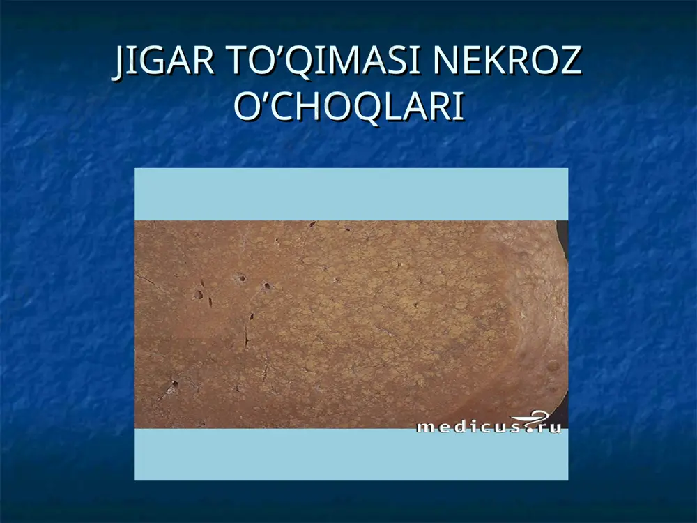 nazoratiga muhtojlar parhez – oqsil miqdorini keskin kamaytirish, oqsil miqdorining keskin kamaytirish kuniga 30-40 g/sut gacha, yog'larni 60 g gacha va uglevodlarni kuniga 200 g gacha cheklash, polivitaminlar, sut-qatiq mahsulotlari. davolash(davomi) intoksikasiya bilan kurashish gemostatiklar diuretikdar ensefalopatiyada preparatы, ammiak metabolizmini kchaytiruvchi vositalar davolashning ekstrakorporal usullari: plazmaferez, gemodializ, gemo- va limfosorbsiya, qonning perfuziya giperbarik oksigenasiya seanslari laktulozani qo'llagan holda tozalovchi huqna qo'yish tuzli surgi dorilar laktuloza elektrolitli komada qonning elektrolitli tarkibini meyoriga keltirish