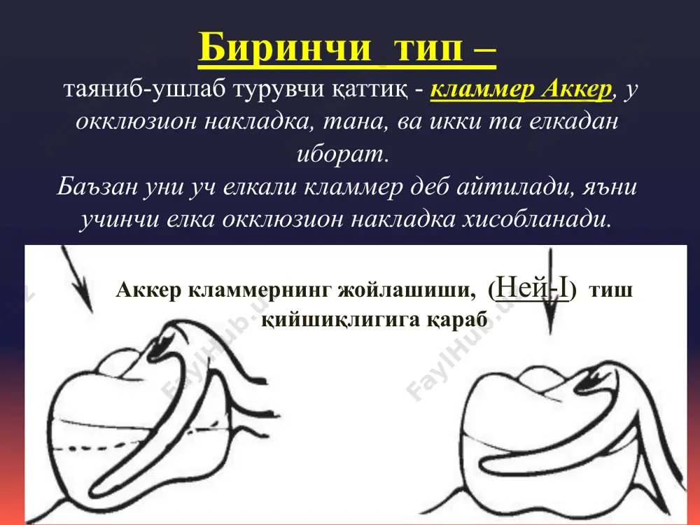 нея «ney» системаси бўйича кламмерлар - Page 3