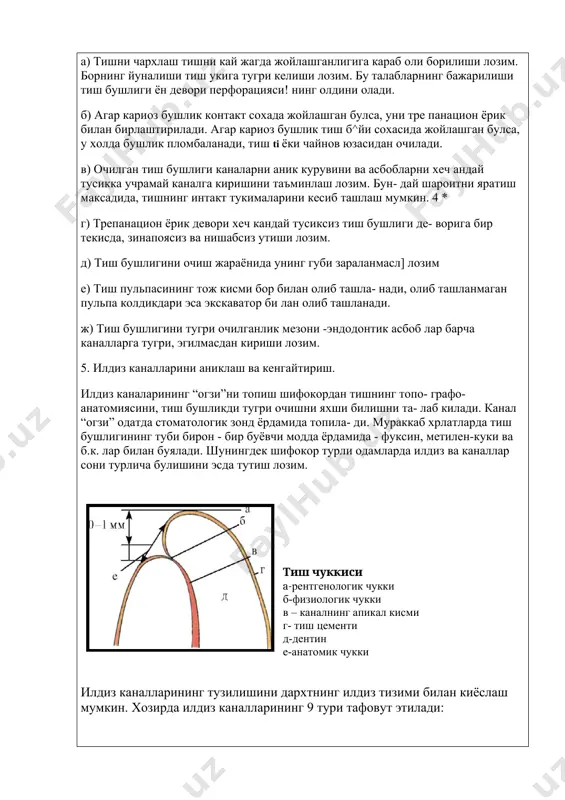олдикдари эса экскаватор би­ лан олиб ташланади. ж) тиш бушлигини тугри очилганлик мезони -эндодонтик асбоб­ лар барча каналларга тугри, эгилмасдан кириши лозим. 5. илдиз каналларини аниклаш ва кенгайтириш. илдиз каналарининг “огзи”ни топиш шифокордан тишнинг топо- графо-анатомиясини, тиш бушликди тугри очишни яхши билишни та- лаб килади. канал “огзи” одатда стоматологик зонд ёрдамида топила- ди. мураккаб хрлатларда тиш бушлигининг туби бирон - бир буёвчи модда ёрдамида - фуксин, метилен-куки ва б.к. лар билан буялади. шунингдек шифокор турли одамларда илдиз ва каналлар сони турлича булишини эсда тутиш лозим. тиш чуккиси a-рентгенологик чукки б-физиологик чукки в – каналнинг апикал кисми г- тиш цементи д-дентин е-анатомик чукки илдиз каналларининг тузилишини дархтнинг илдиз тизими билан киёслаш мумкин. хозирда илдиз каналларининг 9 тури тафовут этилади: 1 .биринчи шакл. пульпа камераси тубидан бошланиб, то илдиз учигача давом этади.. бундай турдаги илдиз канали марказий курак тишларига хосдир. бундай тишларни даволаш кийинчилик тугдирмайди. 2. иккинчи шакл. илдиз каналлари пульпа камераси …