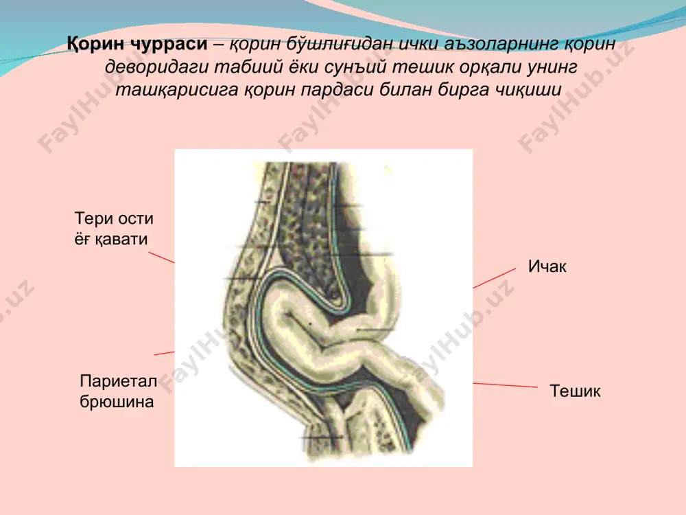 адти даволаш иши - Page 5