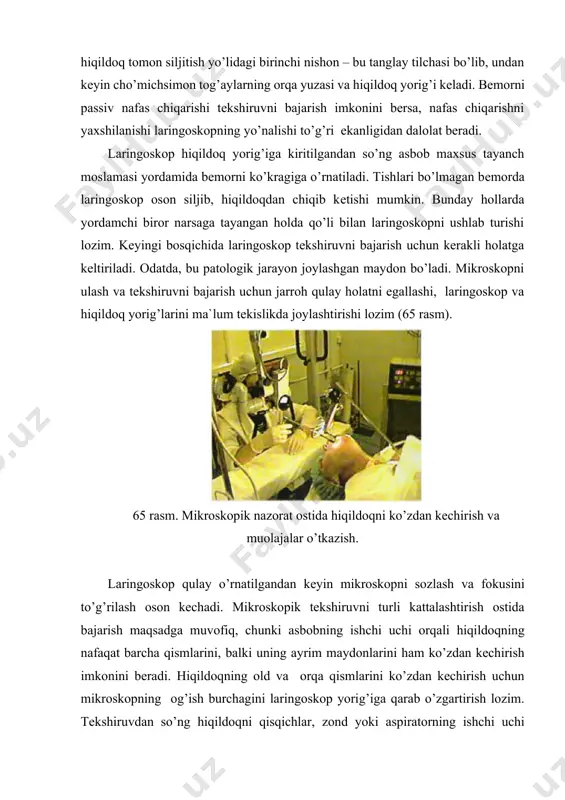 kopni hiqildoq tomon siljitish yo’lidagi birinchi nishon – bu tanglay tilchasi bo’lib, undan keyin cho’michsimon tog’aylarning orqa yuzasi va hiqildoq yorig’i keladi. bemorni passiv nafas chiqarishi tekshiruvni bajarish imkonini bersa, nafas chiqarishni yaxshilanishi laringoskopning yo’nalishi to’g’ri ekanligidan dalolat beradi. laringoskop hiqildoq yorig’iga kiritilgandan so’ng asbob maxsus tayanch moslamasi yordamida bemorni ko’kragiga o’rnatiladi. tishlari bo’lmagan bemorda laringoskop oson siljib, hiqildoqdan chiqib ketishi mumkin. bunday hollarda yordamchi biror narsaga tayangan holda qo’li bilan laringoskopni ushlab turishi lozim. keyingi bosqichida laringoskop tekshiruvni bajarish uchun kerakli holatga keltiriladi. odatda, bu patologik jarayon joylashgan maydon bo’ladi. mikroskopni ulash va tekshiruvni bajarish uchun jarroh qulay holatni egallashi, laringoskop va hiqildoq yorig’larini ma`lum tekislikda joylashtirishi lozim (65 rasm). 65 rasm. mikroskopik nazorat ostida hiqildoqni ko’zdan kechirish va muolajalar o’tkazish. laringoskop qulay o’rnatilgandan keyin mikroskopni sozlash va fokusini to’g’rilash oson kechadi. mikroskopik tekshiruvni turli kattalashtirish ostida bajarish maqsadga muvofiq, chunki asbobning ishchi uchi orqali hiqildoqning nafaqat barcha qismlarini, …