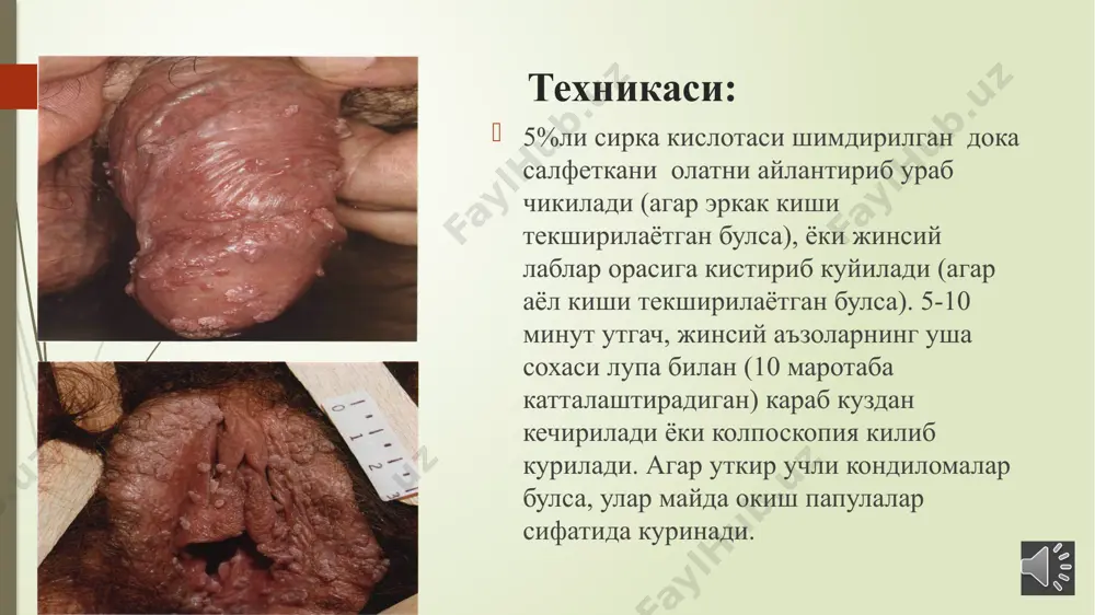 sirkali kislota bilan sinama kuyishi - Page 3