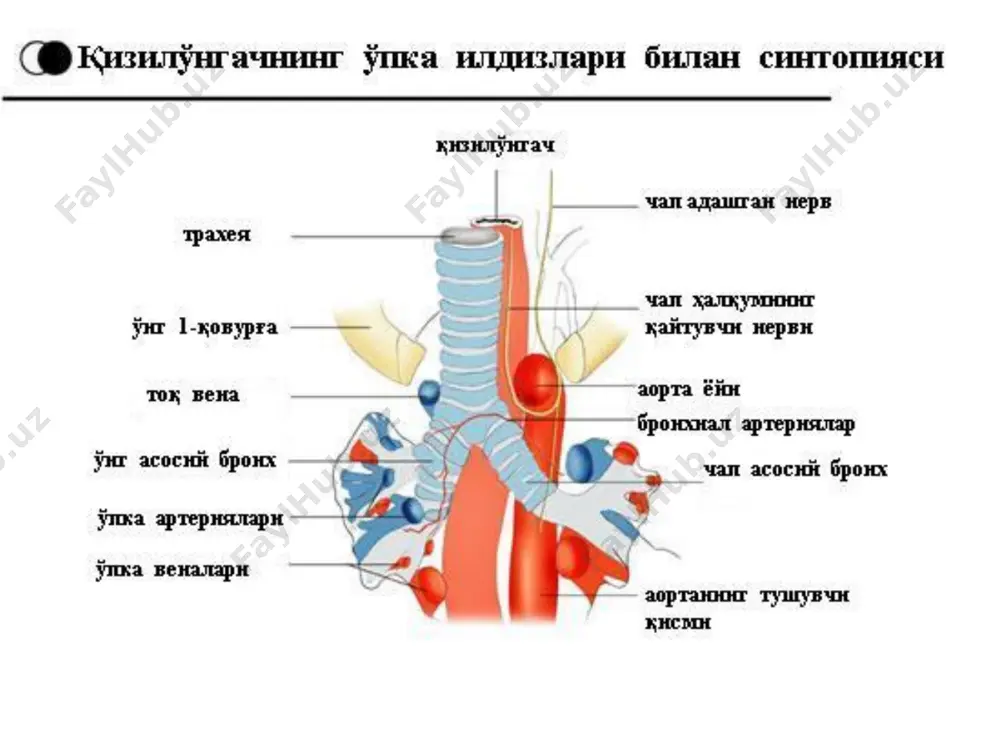 кўриниши: қизилўнгач кенгайган; гастроэзофагал соҳада қизилўнгач бўшлиғининг торайиши – “қуш тумшуғи” симптоми қизилўнгачда қолдиқ барий. ценкер дивертикулининг эндоскопик кўриниши қизилўнгач дивертикуллари қизилўнгач дивертикуллари қизилўнгач деворининг бўртиб чиқишига қизилўнгач дивертикули дейилади. rokitansky 1840 йилдаёқ дивертикулларни пульсион ва тракцион турларга бўлган эди. қизилўнгач дивертикуллари аксарият 5 дан 70 ёшгача, аёлларда эркакларга нисбатан бирмунча кўпроқ учрайди. классификацияси: келиб чиқишига қараб турлари: пульсион дивертикуллар қизилўнгач деворининг қизилўгач ичи босимнинг ошиши натижасида бўртиб чиқиши туфайли ҳосил бўлади. тракцион дивертикулларнинг пайдо бўлиши атроф тўқималардаги яллиғланиш жараёни ва қизилўнгач деворини касал аъзо йўналишида тортадиган (tractio) чандикдар ҳосил бўлиши билан боғлиқ. аралаш жойлашишига қараб турлари: ҳалқум-қизилўнгач ёки ценкер дивертикуллари – 58,7% эпибронхиал (бифуркацион, ўрта қизилўнгач) – 27,2% эпифренал (эпидиафрагмал) – 13,4% классификацияси туғма дивертикуллар орттирилган дивертикуллар ҳақиқий дивертикуллар – девори нормал қизилўнгач деворининг ҳамма қатламларини сақлаган дивертикуллар, сохта дивертикуллар – девори мушак қатламидан маҳрум бўлган дивертикуллар. сохта дивертикуллар прогностик жиҳатдан ёмонроқ, чунки қисилиб қолиши, чўзилиши ва ҳатто тешилиши …