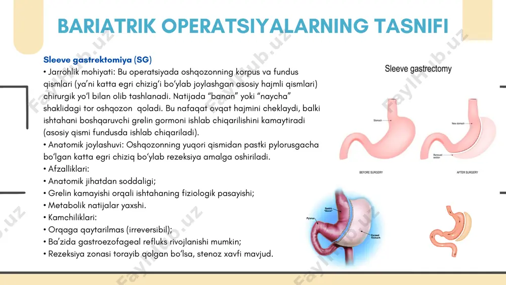 ion usullar ikki asosiy yo‘nalishga bo‘linadi: restriktiv (ovqat hajmini jismonan cheklash) va malabsorptiv (so‘rilish yuzasini kamaytirish) usullar. shuningdek, ularning kombinatsiyalangan turlari ham mavjud. har bir usulning o‘ziga xos afzalliklari va xavflari bor bo‘lib, bemorning klinik holatiga mos individual tanlov muhim ahamiyatga ega. zamonaviy texnologiyalar, xususan laparoskopik va robotik jarrohlik imkoniyatlari operatsiyalarning xavfsizligini oshirib, bemor uchun qulay va tez reabilitatsiyani ta’minlamoqda. topografik-anatomik yondashuvlar esa jarrohlik aralashuvlarining aniqligi va samaradorligini belgilaydi. shu bilan birga, bariatrik operatsiyalar — faqatgina texnik harakat emas, balki uzoq muddatli va kompleks tibbiy yondashuvni talab qiluvchi muolajadir. operatsiyadan keyingi davrda vitamin-mineral defitsitlar, metabolik buzilishlar, ovqatlanish rejimiga rioya qilmaslik kabi asoratlar xavfi mavjud. shu boisdan, har bir bemor bilan uzluksiz monitoring, psixologik tayyorgarlik, dietologik maslahat va laborator nazorat ishlari olib borilishi shart. mazkur mavzuni o‘rganish davomida semizlik muammosining chuqur klinik, anatomik va texnologik jihatlari tahlil qilindi. bariatrik operatsiyalar — zamonaviy tibbiyotning katta yutug‘i sifatida semizlik bilan bog‘liq yurak-qon tomir, …