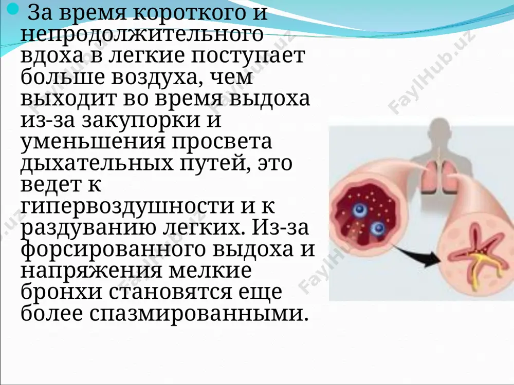 astmatik status (status astmaticus) - Page 3