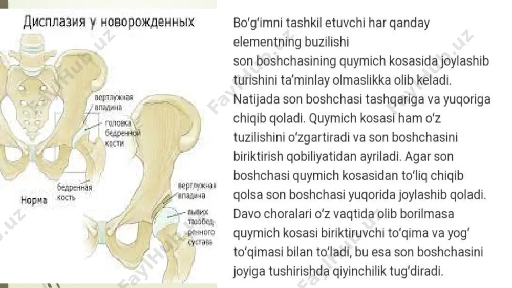 chanozq-son bo’g’imi displaziyasi - Page 5