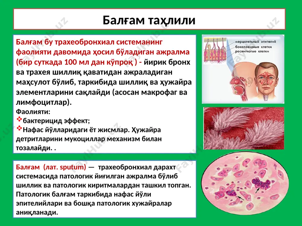 алғамдаги турли хил киритмалар микроскопик текширув ҳужайравий элементлар: ясси эпителий (оғиз бўшлиғи, бурун ҳалқум, овоз пайлари). якка жойлашган хужайралар, хамма вакт учрайди, сулак билан бирга ажралади. цилиндрик эпителий (трахеа ва бронх шиллиқ қаватидан ажралади). бронхиал астма, ўткар бронхит ва нафас йўллари катарал яллиғланишида куп миқдорда аниқлаади. макрофаглар – бронх ва ўпка тўқимаси яллиғланишида сидерофаглар – кичик қон айланиш доирасидаги димланишда, ўпка гемосидерозида . ўсма хужайралари (ясси хужайрали ва безсимон рак, аденокарценома). лейкоцитлар: балғамда камрок, йирингли ажралмада кўпроқ, баъзан эозинофиллар купаяди. эритроцитлар : хар қандай балғамда кам миқдорда бўлади, ўпка инфаркти, қон кетишлари ва ўпк шишида кўп топилади. микроскопик текширув эластик толалар – ўпка туқимаси парчаланишидан дарак беради (туберкулез; ўпка абсцесси ва ўсмалари). фибриноз толалар фибриноз бронхит; туберкулез, актиномикоз, крупоз пневмония куршман спирали – қаттиқ ўралган шиллиқдан таркиб топган спираллар (бронхиал астма). шарко-лейден кристаллари эозинофиллар парчаланиши ва оқсиллар кристализациясидан шаклланади. (ба, ўпканинг йирингли яллиғланиши). холестерина кристаллари, ёғ кислоталари - бўшлиқларда балғам …
