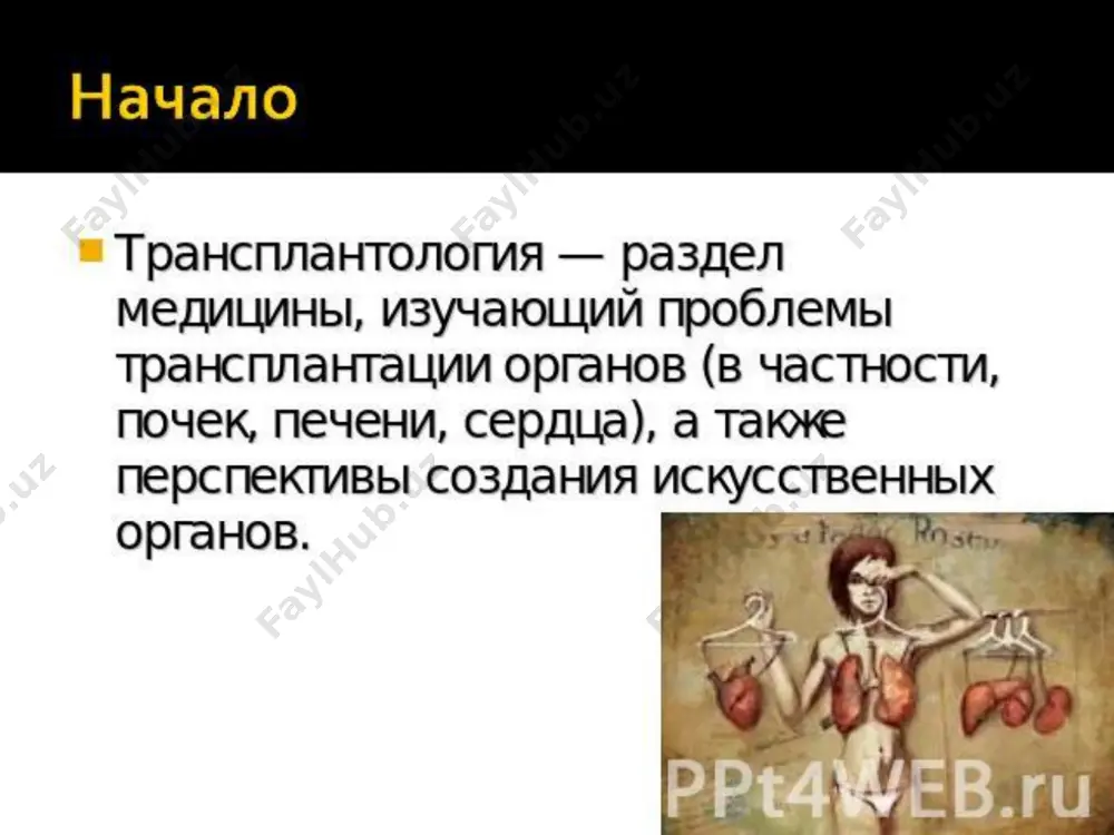 пересадку органов или комплексов органов (трансплантация сердца, почки, печени, поджелудочной железы, комплекса «сердце-лёгкие») и пересадку тканей и клеточных культур (пересадка костного мозга, культуры β-клеток поджелудочной железы, эндокринных желёз и др.). по типу доноров ксенотрансплантация — трансплантация органов или тканей от животного другого биологического вида; аллотрансплантация — трансплантация, при которой донором трансплантата является генетически и иммунологически другой человеческий организм; изотрансплантация - пересадку осуществляют между двумя генетически идентичными организмами (однояйцовыми близнецами). подобные операции редки, так как количество однояйцовых близнецов невелико, кроме того, они часто страдают схожими хроническими заболеваниями. аутотрансплантация — реципиент трансплантата является его донором для самого себя. по месту имплантации органа все трансплантации делят на два вида: орто- и гетеротопические. ортотопическая трансплантация. донорский орган имплантируют на то же место, где находился соответствующий орган реципиента. таким образом осуществляют пересадку сердца, лёгких, печени. гетеротопическая трансплантация. донорский орган имплантируют не на место нахождения органа реципиента, а в другую область. причём неработающий орган реципиента может …