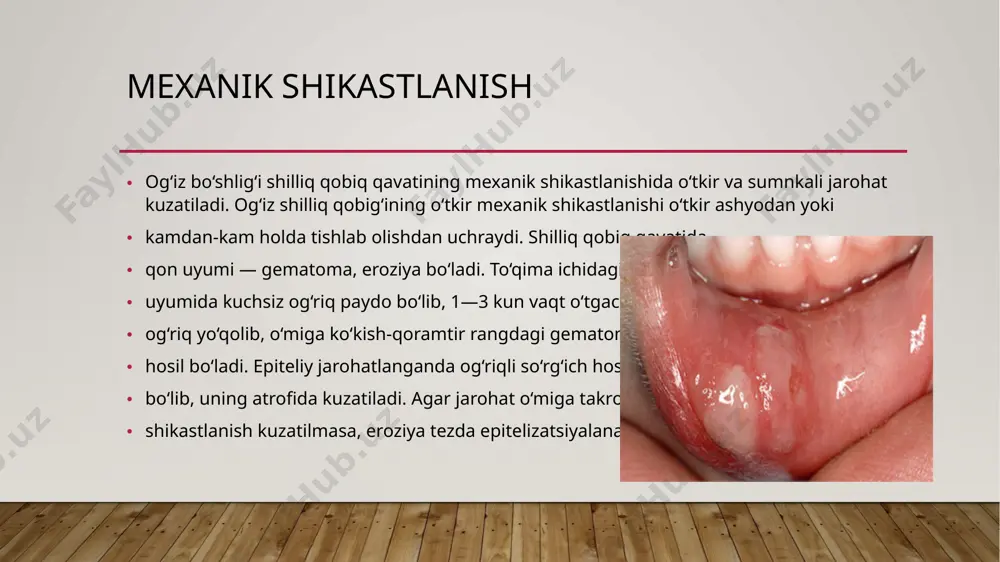 bo‘ladi. kandidoz achitqisimon zamburug‘lar bo‘lib, kandida turkumiga kiradi. kandidozning klinik yuzaga chiqishi va kechishi bemoming yoshiga, jismoniy holatiga, kechirayotgan umumiy kasalliklariga va boshqalarga bog‘liq. shilliq qavat kandidozi: kandidozli stomatit, milk kandidozi, til kandidozi va boshqalarga ajratiladi. kandidozli stomatit ko‘proq ko‘krak yoshidagi bolalarda uchraydi. og‘iz shilliq qavat qobig‘ida, tanglayda, milkda, lunjda oson tilinadigan karashlar paydo bo‘ladi. bu karashlami tilganimizdan keyin tekis, qisman shishli qizargan yuzani ko‘ramiz. karashlar fibrini so‘riladi, natijada oq-ko‘kish rangdagi qo‘pol qatlam hosil bo‘lib, u tubdan shilliq qavat bilan qattiq birikadi. 0 ‘tkir gerpetik stomatit tez yuquvchan bo‘lganligi uchun immun holati shakllanib bo‘lmaganlar orasida ko‘p uchraydi. infeksiya aloqa va havo tomchi yo‘li orqali yuqadi. organizmning umumiy zaharlanishi va kasallikning mahalliy belgilarining yuzaga kelish darajasiga qarab, kasallik yengil, o‘rta va og‘ir shakllarda uchraydi 0 ‘tkir gerpetik stomatitning aniq belgilaridan biri, bu so‘lak ajralishining kuchayishi, so‘lakning quyqalashishi, og‘izda hid paydo bo‘lish holatlari kuzatiladi lab kasalliklari angulyar xeylit bu surunkali qaytalanuvchi kasallik …