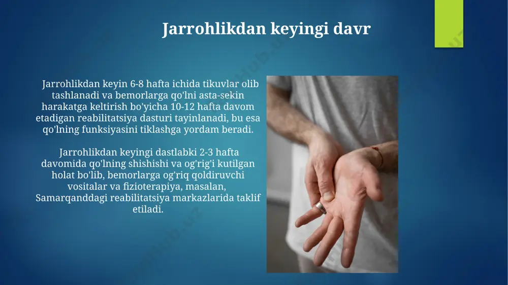 'lishi mumkin. dupuytren kontrakturaning genetik komponentga ega ekanligi isbotlangan, ammo aniq genlarning 20 dan ortiq bo'lishi aniqlangan. kasallikning rivojlanishiga irsiy moyillik va atrof-muhit omillari ta'sir qiladi, masalan, chekish va alkogol iste'moli. kasallikning oldini olish dupuytren kontraktturasining oldini olishda, ayniqsa, 50 yoshdan oshgan erkaklar va shimoliy evropa mamlakatlari aholisi orasida genetik moyillikni aniqlash va muntazam tibbiy ko'rikdan o'tish muhim ahamiyatga ega. sog'lom turmush tarzini olib borish, jumladan, chekishdan voz kechish va muntazam jismoniy mashqlar bilan shug'ullanish, 3-4 yil ichida dupuytren kontraktaturasining paydo bo'lish xavfini sezilarli darajada pasaytiradi. fizioterapiya va reabilitatsiya samarqanddagi fizioterapiya mutaxassislari tomonidan qo'llaniladigan qo'lning passiv va aktiv harakatlarini o'z ichiga olgan reabilitatsiya dasturi, 3 oy davomida 5-7 kunlik mashg'ulotlar bilan, kontrakturani oldini olish va qo'lning funksiyasini takomillashtirishga yordam beradi. dupuytren kontraktürasiga chalingan bemorlarda qo'lning funksiyasini tiklash maqsadida o'zbekistonning toshkent shahridagi reabilitatsiya markazlarida 6-8 haftalik davolash kursi qo'llaniladi, bu yerda 10-15 marta terapevtik mashqlar bajariladi. davolash usullari: jarrohlik amaliyoti jarrohlik …
