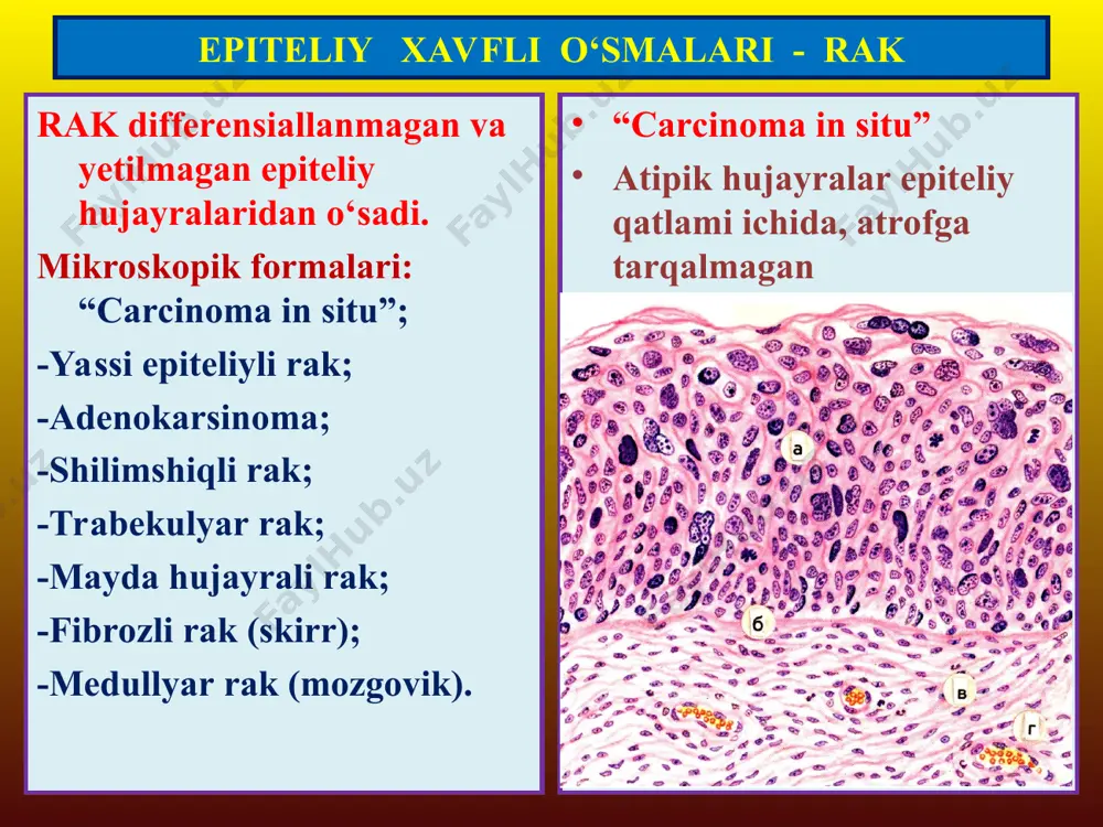 epitelial va mezenximal o’smalar - Page 5