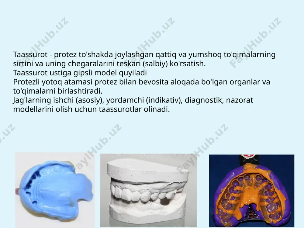 oki alveolyar jarayondan kamida 3-5 mm masofada bo'lishi kerak, bir xil masofa qattiq tanglay va qoshiqning palatin bo'rtiqlari orasida bo'lishi kerak; qoshiqning o'lchami tish uzunligiga mos kelishi kerak: uzunligi bo'yicha - 5-10 mm ga ko'proq kengligi - qolgan tishlardan 2 barobar kengroq tish bo'shlig'iga qo'llanganda, qoshiqing qirralari o'tish burmasiga etib borishi kerak, lekin unga to'g'ri kelmasligi kerak, aks holda faol yoki passiv harakatlar yordamida taassurot qirralarini hosil qilish mumkin bo'lmaydi. 18 борта ложки ручка ложки угол ложки перфорация небная выпуклость оттиски по назначению рабочие вспомогательные по методике анатомический функциональный по степени компрессии разгружающие компрессионные дифференцированные классификация оттисков по е.г. гаврилову anatomik qolip funktsional testlardan foydalanmasdan standart yoki individual qoshiqda bilan olinadi.. funktsional qolip, protez yuzasining chegarasida joylashgan o'tish va boshqa shilliq qavatlarning harakatchanligini aks ettirishga imkon beruvchi maxsus funktsional testlar yordamida qoshiq bilan olinadi. funktsional qolip odatda tishsiz jag'lardan va ko'rsatkichlarga ko'ra, tishlarini qisman yo'qotgan jag'lardan olinadi. shifokor bemorning lablari …