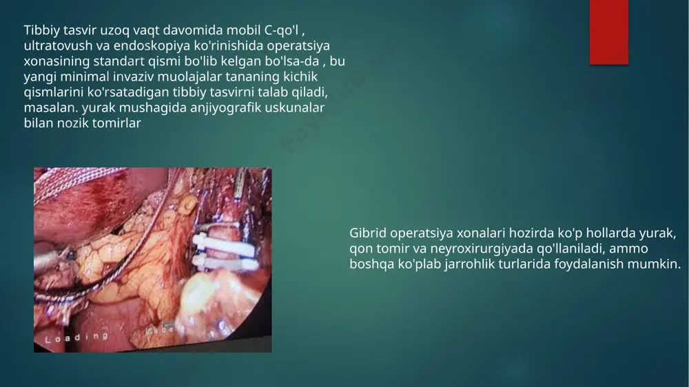 svirlash tizimini tanlashga qarab, uskunani nazorat qilish xonasini o'z ichiga olgan holda, texnik va tayyorgarlik xonalari bundan mustasno, 70 kvadrat metrlik xonaga ega bo'lish tavsiya etiladi. bundan tashqari, tibbiy tasvirlash tizimi tomonidan chiqariladigan radiatsiyadan himoya qilish uchun 2-3 mm qalinlikdagi qo'rg'oshin qalqoni o'rnatilishini ta'minlash kerak. bundan tashqari, tanlangan tibbiy tasvirlash tizimiga qarab, tibbiy tasvirlash tizimining qo'shimcha og'irligini qo'llab-quvvatlash uchun zamin yoki ship tuzilishini mustahkamlash kerak bo'lishi mumkin. (taxminan vazni 650-1800 kg) operatsiya xonasida ish jarayoni tahrirlash gibrid operatsiya xonasini rejalashtirish ko'plab tomonlarning ishtirokini talab qiladi. operatsiya xonasida silliq ish jarayonini ta'minlash uchun operatsiya xonasida ishlaydigan barcha tomonlar o'z vazifalarini bajarish qobiliyatini ta'minlash uchun o'z talablarini o'z vaqtida belgilashlari kerak. bu talablar fazo, tibbiy va tasvirlash uskunalari kabi parametrlar orqali xonaning yakuniy dizayniga ta'sir qiladi . shu sababli, samarali gibrid operatsiya xonasini rejalashtirish professional loyiha menejerini jalb qilishni talab qiladi. bundan tashqari, rejalashtirish bir necha takrorlashda sodir bo'lishi mumkin. iteratsiyalar bizga …