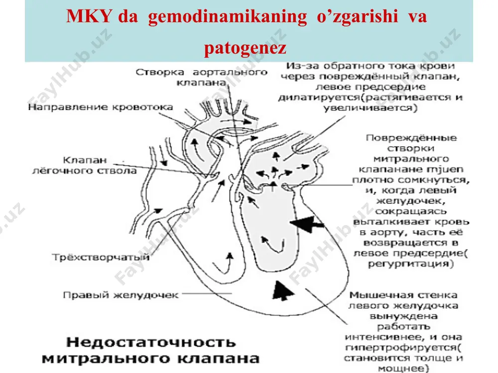 apga va pastga siljigan. son arteriyasida ikkilamchi shovqin (dyurozye shovqini) yurak chegaralari chapga va pastga siljigan,chap qorincha kattalashgani hisobiga “etik” formasida i ton susayishi, kuchaygan diastolik shivqin, ii tonning aortal komponentidan keyin darxol keladi, 1- va 5- nuqtalarda eshitiladi, max 5- nuqtada