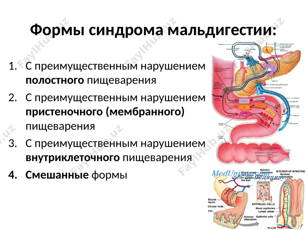 основные синдромы при заболеваниях кишечника - Page 5