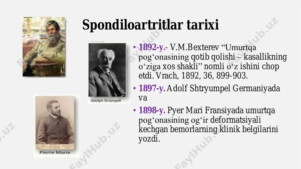 bilan shug‘ullanadigan bo‘lgani uchun, ularning bel og‘rig‘i noto‘g‘ri talqin qilinishi mumkin. 4. tasviriy tekshiruvlarda kech paydo bo‘lishi • asning asosiy diagnostikasi rentgen va mri orqali amalga oshiriladi. • rentgenologik o‘zgarishlar (sakroiliit) kasallik boshlanganidan 3-5 yil o‘tibgina ko‘rinadi, shuning uchun erta tashxis qo‘yish qiyinlashadi. • mri erta bosqichdagi yallig‘lanishni aniqlay oladi, ammo ba’zi joylarda bu tekshiruv o‘tkazilmaydi yoki qimmat bo‘lishi mumkin. 5. hla-b27 geni har doim ham ishonchli bo‘lmasligi • hla-b27 geni ankilozlovchi spondilit bilan bog‘liq bo‘lsa ham, uning mavjudligi kasallik borligini to‘liq tasdiqlamaydi. • ayrim bemorlarda bu gen bo‘lmasa ham as rivojlanishi mumkin. • shuningdek, hla-b27 geni bor odamlarda ham kasallik hech qachon rivojlanmasligi mumkin. 6. boshqa kasalliklar bilan aralashib ketishi • as bel og‘rig‘idan tashqari bo‘g‘imlar, ko‘z, ichak va yurak muammolari bilan namoyon bo‘lishi mumkin. • ko‘z yallig‘lanishi bo‘lgan bemorlar oftalmologga, ichak muammosi bo‘lganlar gastroenterologga murojaat qilishadi. • natijada bemor uzoq vaqt boshqa mutaxassislarga borib yuradi va revmatologga kech …