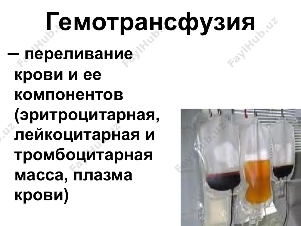 , в сыворотке агглютинины  и . группа а (ii) — в эритроцитах агглютиноген а, в сыворотке агглютинин . группа в (iii) — в эритроцитах агглютиноген в, в сыворотке агглютинин . группа ав (iv) — в эритроцитах агглютиногены а и в, агглютининов в сыворотке нет. в настоящее время в системе аво известны разновидности классических антигенов а и в, а также другие антигены. группы крови по ав0 группа крови агглютиногены эртироцитов агглютинины плазмы 0 (i) 0 αβ а (ii) а β в (iii) в α ав (iv) ав 0 методика определения групп крови по стандартным изогемагглютинирующим сывороткам, по стандартным изогемагглютинирующим сывороткам и стандартным эритроцитам (перекрестный способ), с помощью моноклональных антител (цоликлонов анти-а и анти-в). определение группы крови ав0 определение групп крови цоликлонами группа крови анти-а анти-в 0 (i) - - а (ii) + - в (iii) - + ав (iv) + + клиническое значение групповой дифференциации для физиологии и патологии человека …