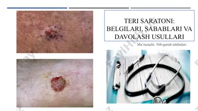 teri saratoni malumoti — PPTX
