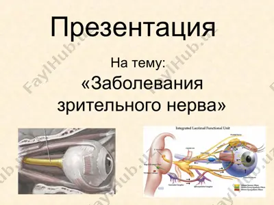 "заболевания зрительного нерва" — PPT