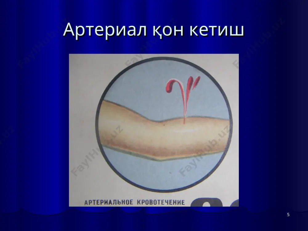 "қон кетиш ва уни тўхтатиш усуллари" мавзusida amaliy mashgulot - Page 5