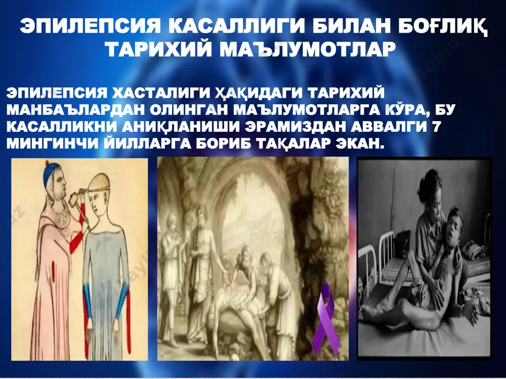 нтлиги курсатади. ирсият йули билан касаллик узи утмайди, балки талвасага тайёрганлиги утиб кетади. 2. ортирилган мойиллиги - хомила ва эрта постнатал пайтида бош миянинг экзоген- органик бузилишлар ва перинатал билан постнатал боскичлардаги бош миянинг шикастланишлар билан богланган булади. 3. тугрук пайтидаги бош миянинг шикастланишлар. патогенези касаллик патогенезида иккита механизм ажратилади: касалликни ривожланиш патогенези; 2. талвасани ривожланиш патогенези касалликни ривожланиш патогенези касалликни ривожланиш патогенезида хар хил биохимик бузилишлар рол уйнайдилар, булардан катта рол уйновчи: 1. оксил-азотли алмашувининг бузилиши.бу натижада кондаги аммиак азоти кутарилади, мочевина азоти эса камаяди; 2. сув-тузли алмашувининг бузилиши.альбумин-глобулинли нисбати ва k-na бароварлигини бузилишлардан иборат. 3. кислота-ишкор бароварлигини бузилишлар. тутканокдан олдин алкалоз кузатилади, тутканокдан кейин эса – ацидоз. 4. углеводлар алмашувини бузилишлари. 5. мия метаболизмни бузилиши биоген аминлар, норадреналин микдорлари камаяди, серотонин,ацетилхолиннинг микдорлари эса усиб боради. ацетилхолин асаб импульсларни йуналишида ёрдам беради – иррадиацияни кучайтиради. шу натижада гамк микдорлигини купайтириш керак, унинг учун беморга вит в6 билан глютаминли кислотани …
