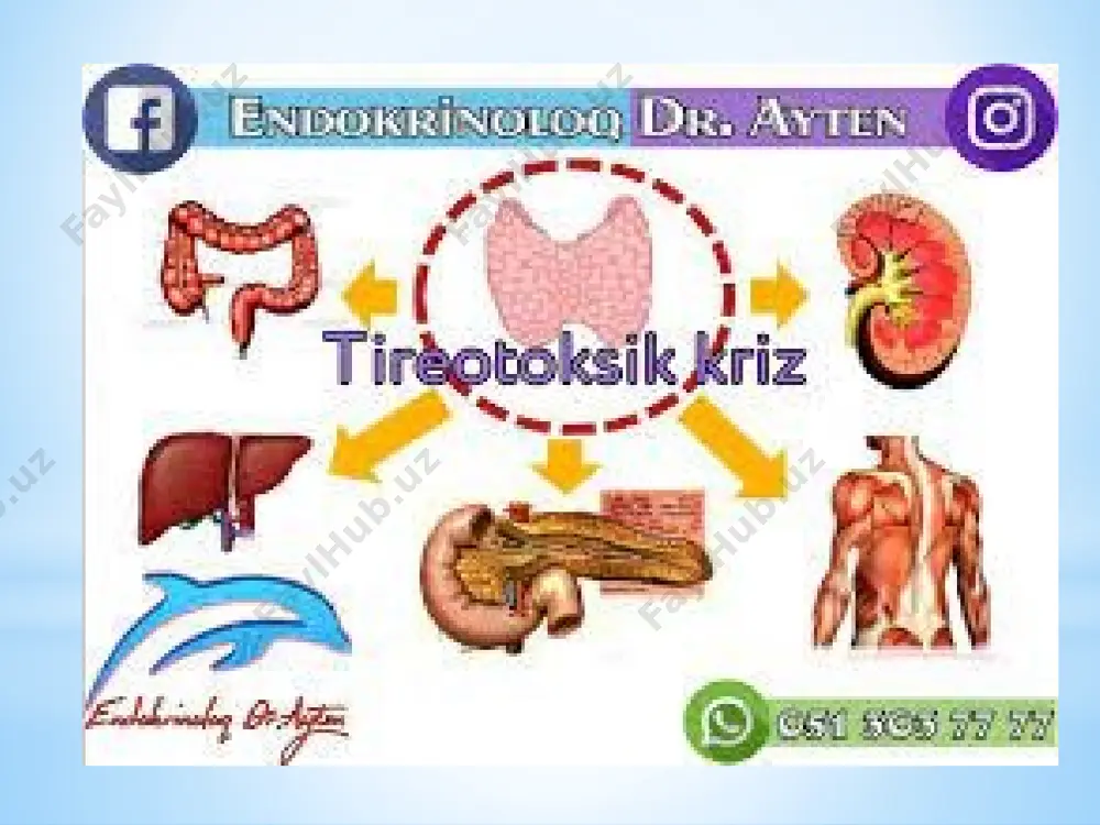 ning yuqori darajasini darhol kamaytirishdir va kasalxonalarning reanimatsiya bo'limida o'tkazilishi kerak: 1. giyohvand moddalarni davolash. qalqonsimon bez gormonlarining sekretsiyasini bostirish uchun darhol 10 mg 10% natriy yodid yoki 1% lugol eritmasi natriy yodid bilan 1 litr 0,9% natriy xlorid yoki 5% glyukoza bilan suyultiriladi, qalqonsimon bez gormonlarini ishlab chiqarishni darhol blokirovka qilish uchun yuqori dozada tirostatiklar: tiamazol 40-80mg 8 soat davomida, merkazolil 10mg har 2 soatda (sutkalik doza 100-160mg gacha), 0,5-1,0l 0,9% natriy xlor yoki 5% glyukoza uchun kuniga 400-600mg gidrokortizon yoki kuniga 200-300mg prednizolon, t4 ning t3 ga aylanishini inhibe qiladi, buyrak usti etishmovchiligini qoplaydi, sedativlar - diazepam, haloperidol, beta-blokerlar (propranolol, esmolol) - katekolaminlarga sezgirlikni pasaytiradi, yurak urishini pasaytiradi, t4 ning t3 ga aylanishini inhibe qiladi, yurak glikozidlari - strofantin, korglikon, tuzli eritmalarni vena ichiga yuborish orqali suvsizlanishni to'g'irlash., sun'iy oziqlantirish, tromboembolik asoratlarning oldini olish. agar kerak bo'lsa, mexanik shamollatish bilan nafas olishni qo'llab-quvvatlang va kardiotonik dorilar bilan qon …