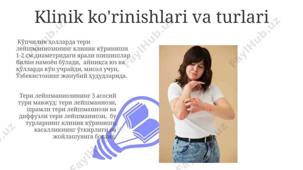 leyshmaniyoz teri shakli - Page 3