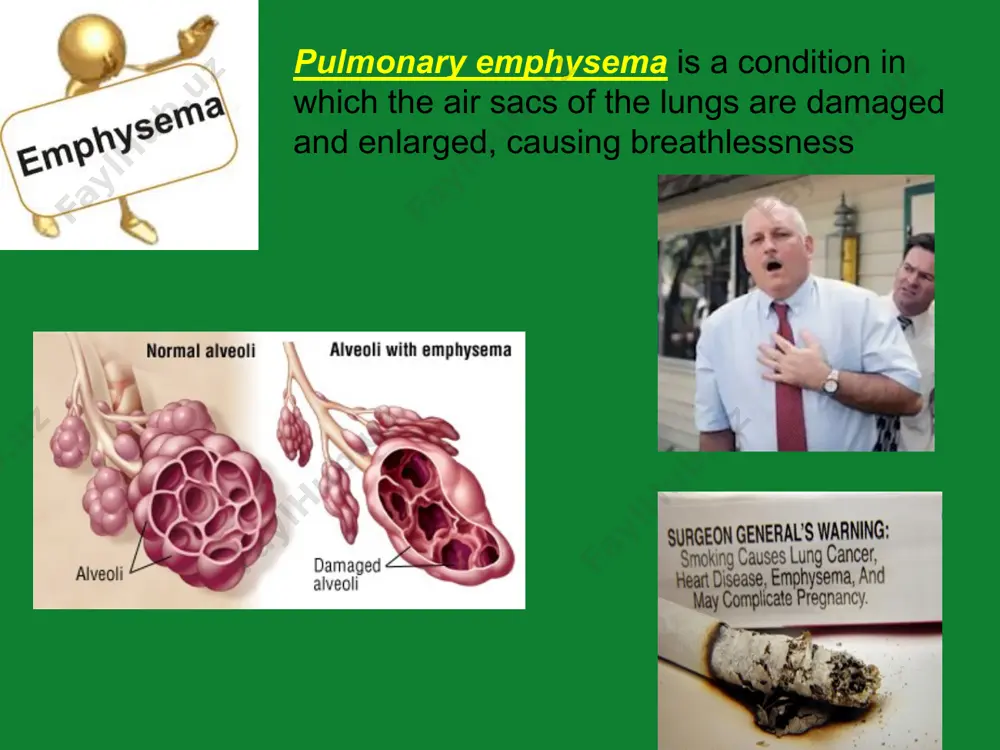 respiratory diseases - Page 5