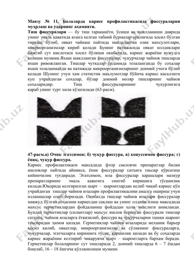 тиш фиссуралари муҳрлаш — DOCX