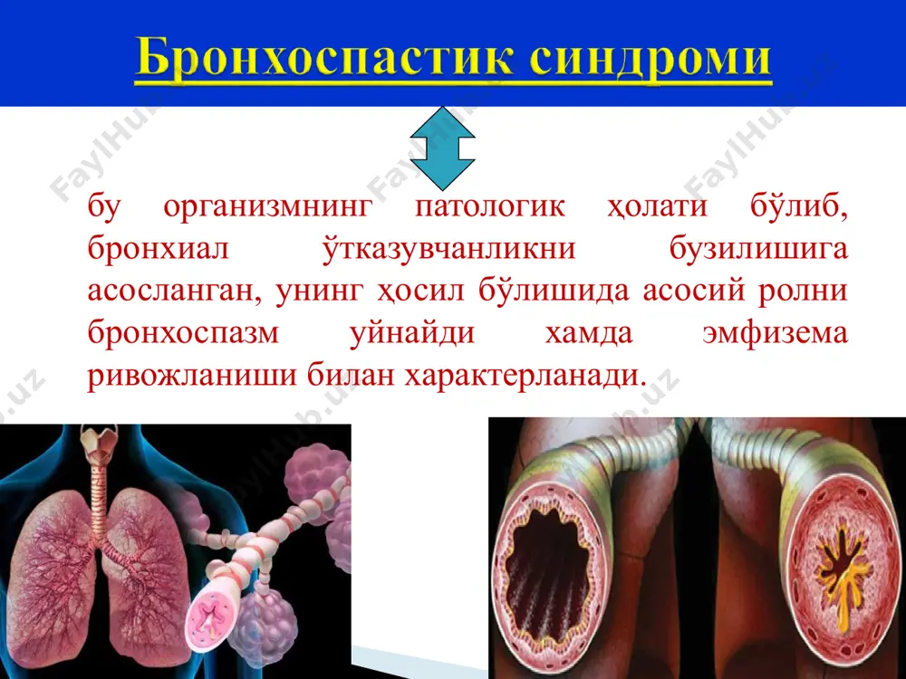 итилиши мумкин. бронхофонияни кучайиши. крепитация ўпка тўқимасининг зичлашиш синдроми (бўлакли ва ўчокли) лаборатор-инструментал текширишлар кон таҳлили: лейкоцитлар сони 15*109 - 25*109гача ошади ва 80-90% лейкоцитларни нейтрофиллар ташкил килади, купинча лейкоцитар формула чапга силжиган. эозинофиллар сони камаяди ва огир холларда бутунлай йуколиши мумкин. лимфопения и моноцитоз кузатилади, эчт ошади. балгам таҳлили: қизариш даври- ёпишкок, кизгиш тусли, куп оксил тутади, озрок лейкоцитлар, эритроцитлар, альвеоляр хужайралар, макрофаглар. қизил жигарланиш даври-балгам озрок, зангсимон рангда, фибрин, шаклли элементлар тутади. қўнгир жигарланиш даври- балғамда лейкоцитлар сони ошади, у шиллик йирингли бўлади. тузалиш даври –лейкоцитлар детрит массага айланади, куплаб макрофаглар пайдо булади. микроблардан пневмококклар, стафилококклар, стрептококклар, фридлендер диплобациллалари топилади. марказий рак пневмония экссудатив плеврит ўпка инфаркти рентгенологик: ўпканинг ўзгариши касалликнинг босқичига боғлиқ. бошида ўпка накшининг кучайиши, сунгра бир-бирига кушилиб кетувчи сояланиш учоклари пайдо булади. хосил булган соя кўпинча ўпка булагига тугри келади. ўпка рентгенологик ўзгаришлар динамикаси даволаш жараёнини бошланиш даврига боғлиқ. ўпкада бўшлиқ ҳосил бўлиш синдроми фиброз …