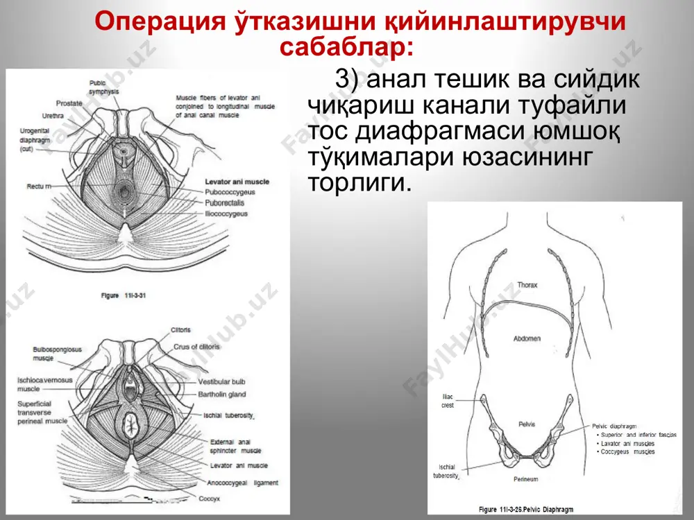 ўли жароҳатланганда сийдик жойлашиши ва тарқалиши патологик ҳолатлар крипторхизм мояк истисқоси варикоцеле гипоспадия патологик ҳолатлар қин ва бачадон аномалиялари. бачадон аноманиялари. бачадон тушиши. гидросалпинкс. цистоцеле. ректоцеле. патологик ҳолатлар мегаколон (гиршпрунг касаллиги) - чамбар ичак турли қисмларининг “туғма аганглиози». ичакнинг зарарланган жойи кескин торайиши оқибатида проксимал бўлими кенгайиб кетади. кўпинча аганглионар зона тўғри ичакнинг оралиқ ва ампула қисмларида, сигмасимон ичакнинг дистал қисмида жойлашади, натижада мегаколон ривожланади. тўғри ичак тушиши. аноректал ва урогенитал туғма нуқсонлар турлари жуда кўп тўғри ичакнинг туғма ривожланиш нуқсонлари 5000-10000 чақалоқнинг биттасида учрайди. эмбриогенезда сийдик йўллари ва тўғри ичакнинг дифференциаллашув босқичлари эмбрионнинг дастлабки уч ҳафтасида охирги ичак бирламчи буйрак канали билан қўшилиб умумий бўшлиқ - клоака ҳосил қилади. 4-ҳафта охирида клоака тўсиқ воситасида олд ва орқа бўлимларга ажралади. олдинги найчадан сийдик найи ва қовуқ, орқа найчадан тўғри ичак ва анус ривожланади. клоака пардасининг дистал қисмида юқорига, охирги ичакнинг пастки учига томон йўналувчи бўртиқ ҳосил бўлади ва улар ўзаро …