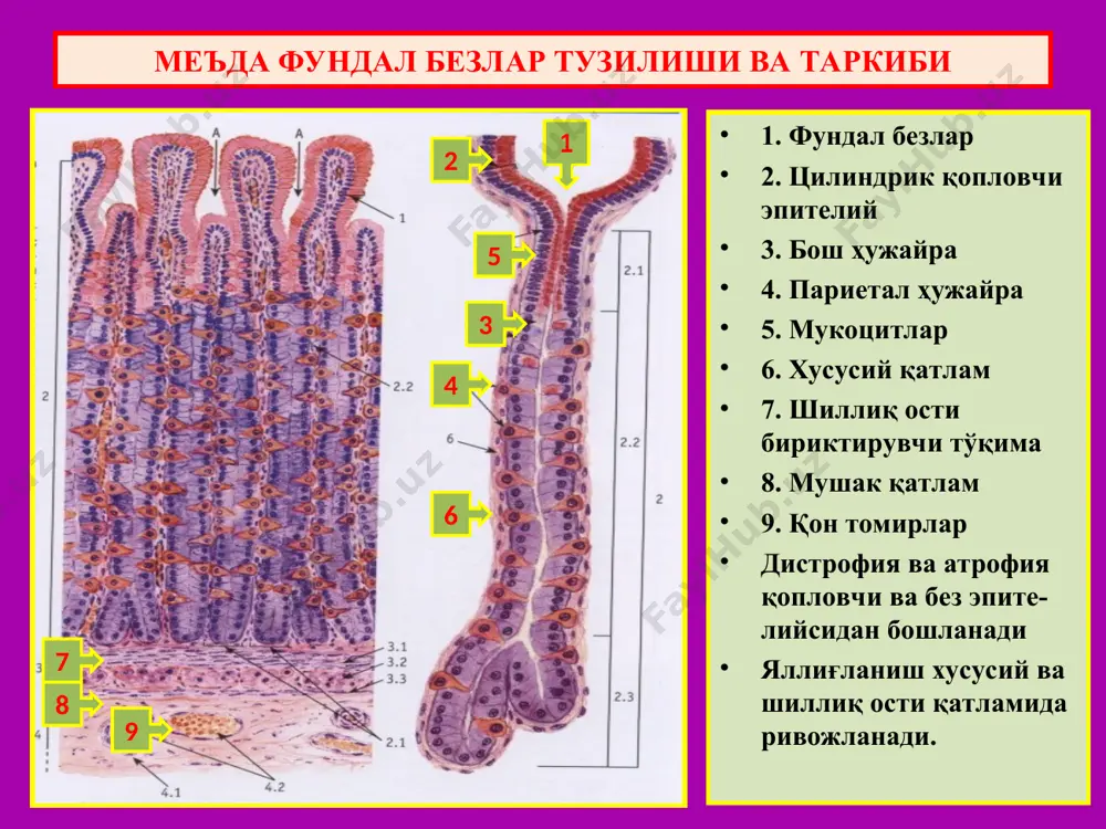 р атрофияланиб, пилорик безларга айланган. хусусий қатлам диффуз яллиғланиш инфильтрати билан қопланган. сурункали атрофик гастрит фундал безлар тўлиқ қайта тузилган юза қопловчи ҳамда без эпителийси орасида қадоҳсимон ҳужайралар пайдо бўлган. метаплазия ва энтерализация ривожланган хусусий қаватда лимфоид фолликула пайдо бўлган сурункали атрофик гастрит яра касаллиги яра касаллиги, бу – сурункали циклли кечувчи касаллик бўлиб, асосий клиник-морфологик белгиси меъда ёки 12 б.и да рецидивланадиган яра пайдо бўладиган касалликдир. этиология ва патогенези: 1) helicobacter pilory (австралиялик патологоанатом робин уоррен топган ва 2005 йил нобел мукофотини олган); 2) нпвс – нестероидные противовоспалительные средства – яллиғланишга қарши ностероид моддалар; 3) руҳий толиқишлар ва зўриқишлар. патогенези: 1) умумий; 2) маҳаллий омиллар. маҳаллий – нейро-гуморал бузилишлардан кислота-пептик омил, шиллиқ парда тўсиғи, моторикаси бузилиб морфологик ўзгаришлар пайдо бўлади. умумий – нейроген зўриқиш ва толиқишлар оқибатида бош мия пўстлоғи бошқаруви бузилиб, оралиқ мия ва гипоталамусга таъсир кўрсатади, натижада адашган нерв қўзғалиб, тонуси ошади, натижада кистола-пептик омил фаоллашади, моторика …