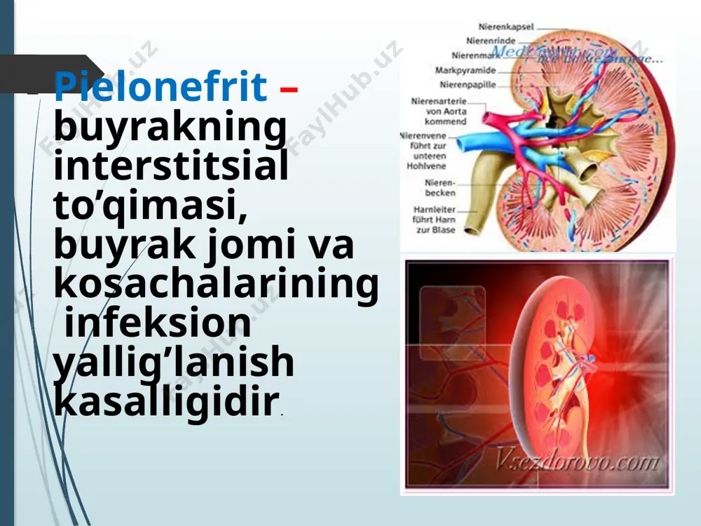 rit 1. shikoyati. xastalikning boshlang'ich davrida muayyan shikoyat deyarli yo'q. bemor asta-sekin oza boshlaydi, kuch-quvvat kamaya boradi. loqaydlik avj olaveradi, tez charchashlik va bosh ogrigi bezovta qiladi. vaqt o'tishi bilan dispepsiya buzilishlari (ishtaha yo'qoladi, og'izda kakra taam sezilishi, ayniqsa ertalab, qorinda og'irlik sezgisi, sababsiz ich surishi, metiorizm) qo'shiladi. bemorlar yuz terisi bo'zarishiga va shishga, subfebril haroratga, belda simillovchi og'riqqa yoki noxush sezgiga noliydilar. xactalikning zo'rayish davrida yuqori harorat, et uvishishi va ko'p terlash, hamda zaharlanish va dizuriya belgilari bilan (siydikni kam miqdorda tez-tez, achishib ajralishi) kuzatiladi. 2. ko'rish. bemorning umumiy holati uzoq vaqt qoniqarli saqlanadi. teri rangi bo'zargan, yuzi ko'pchigan va ko'z osti xaltacha bo'lib osilib turadi. til quruq, qizil, kulrang qarasht bilan qoplangan. xastalikning buyrak faoliyati etishmovchiligi bilan kuzatiladigan oxirgi bosqichida og'izda xarakterli hid, gemorragik diatez belgilari (burundan va milkdan qon ketishi) namoyon bo'la- di. surunkali pielonefritda odatda shish yo'q. xasta- lik kechishida nefrotik holatning rivojlanishi amilo- idoz ko'rsatkichi …