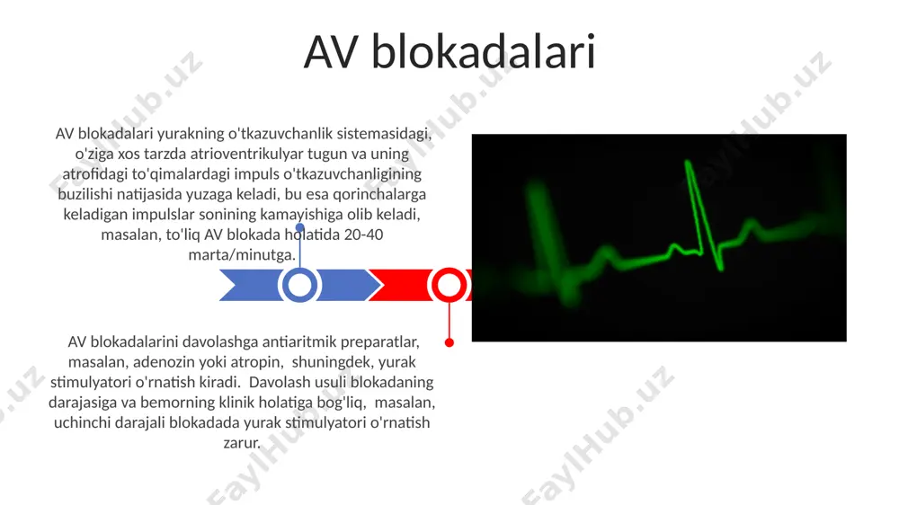 shiga olib keladigan 30 dan ortiq sabablar mavjud, jumladan, ishemiya, miokardit, elektrolitik nomutanosiblik va genetik omillar kabi turli xil kasalliklar va holatlar. yurak qo'zg'aluvchanligining buzilishiga kirish atrioventrikulyar tugun va o'tkazuvchanlik yo'llarining buzilishlari atrioventrikulyar tugunni blokadasining 1-darajali shakli yurak urishining har bir p to'lqini qrs kompleksini keltirib chiqarishi bilan tavsiflanadi, ammo pr intervalli 0,2 sekunddan oshadi. atrioventrikulyar tugun va o'tkazuvchanlik yo'llarining buzilishlari turli xil darajadagi av blokadalarini, masalan, to'liq (iii daraja) av blokadalarini keltirib chiqarishi mumkin, bu holatda atriyal va ventrikulyar ritmlar mustaqil ravishda ishlaydi. yurak qo'zg'aluvchanligining buzilishi diagnostikasi va davolash davolashda antiaritmik dorilar, masalan, i, ii, iii toifa antiaritmiklar qo'llaniladi, dozasi bemorning yoshi va kasallikning og'irligiga qarab individual ravishda tanlanadi. yurak qo'zg'aluvchanligining buzilishini aniqlashda ekg, holter monitoringi va elektrofiziologik tekshiruvlar muhim ahamiyatga ega bo'lib, qt oralig'ining uzayishi kabi o'zgarishlarni aniqlashga yordam beradi. supraventrikulyar taxikardiyalar supraventrikulyar taxikardiyalar yurakning yuqori qismlarida, ya'ni atriyada yoki atrioventrikulyar tugunda kelib chiqadigan tezlashgan yurak urishi (100 …